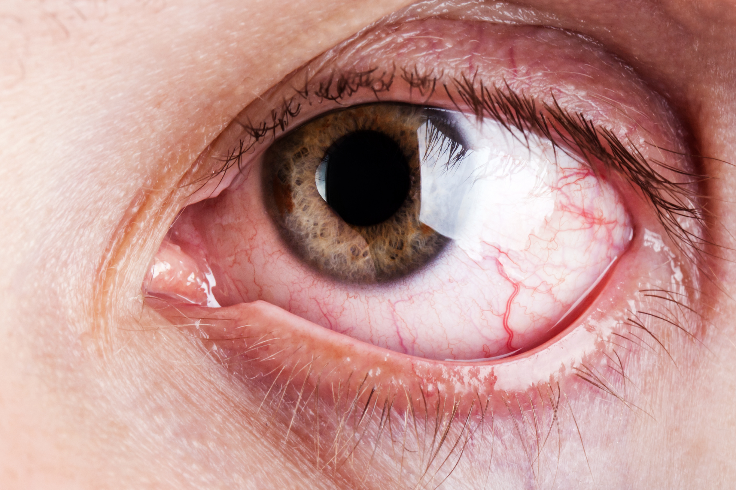 Blood capillary human eye